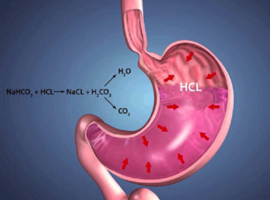 Мучит постоянная изжога? Возможно, у вас ГЭРБ